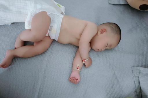 大丰宝宝突然很多眼屎